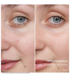 Power Serum Ampoules. Ceramide - DOCTOR BABOR 5 Power Serum Ampoules. Ceramide - DOCTOR BABOR -Cosmeticos24h Tienda de ventas Power Serum Ampoules Ceramide DOCTOR BABOR 655