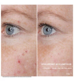 Power Serum Ampoules. Hyaluronic Acid - DOCTOR BABOR -Cosmeticos24h Tienda de ventas Power Serum Ampoules Hyaluronic Acid DOCTOR BABOR 651