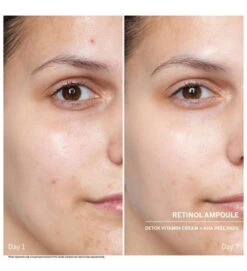 Power Serum Ampoules. Retinol - DOCTOR BABOR -Cosmeticos24h Tienda de ventas Power Serum Ampoules Retinol DOCTOR BABOR 659